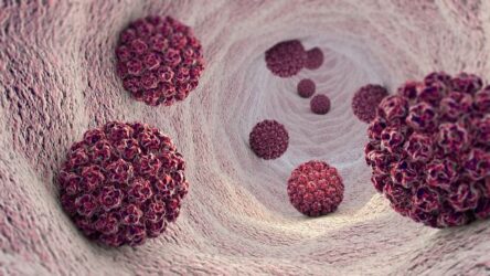 Speiseröhrenkrebs durch HPV