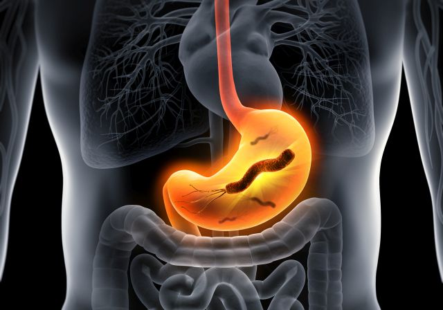 3D-Illustration der Organe des menschlichen Oberkörpers mit bunt hervorgehobenem Magen, in dem Bakterien in Stäbchenform (Helicobacter pylori) zu sehen sind.