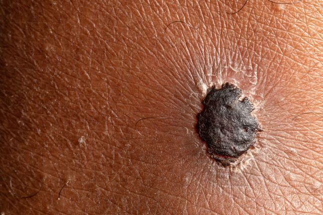 © Alessandro_Gradini_stock.adobe.com