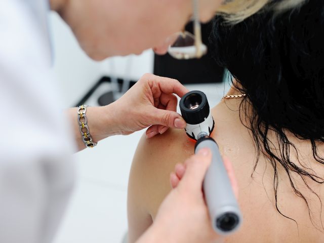 Melanomdiagnose. Der Arzt untersucht das Muttermal des Patienten