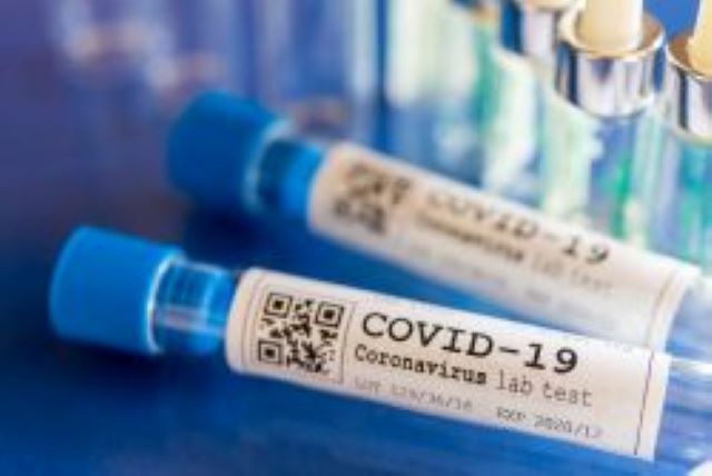 COVID-19-Testproben in Laborröhrchen mit blauen Verschlüssen auf einem Labortisch