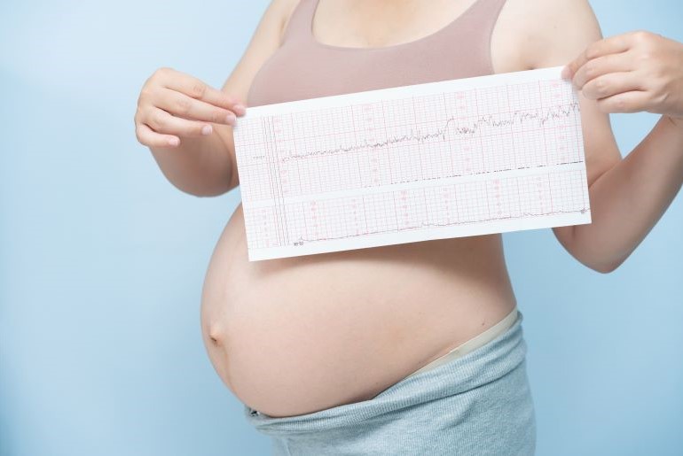 Eine schwangere Frau hält einen EKG-Streifen vor ihrem Bauch. Sie trägt ein rosa Top vor blauem Hintergrund.