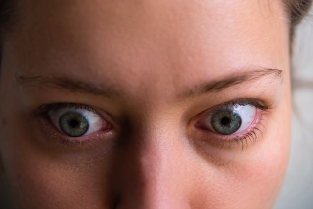 Frau mit hervortretenden Augen