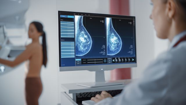 Mammographie-Bildanalyse auf einem Monitor während einer Untersuchung