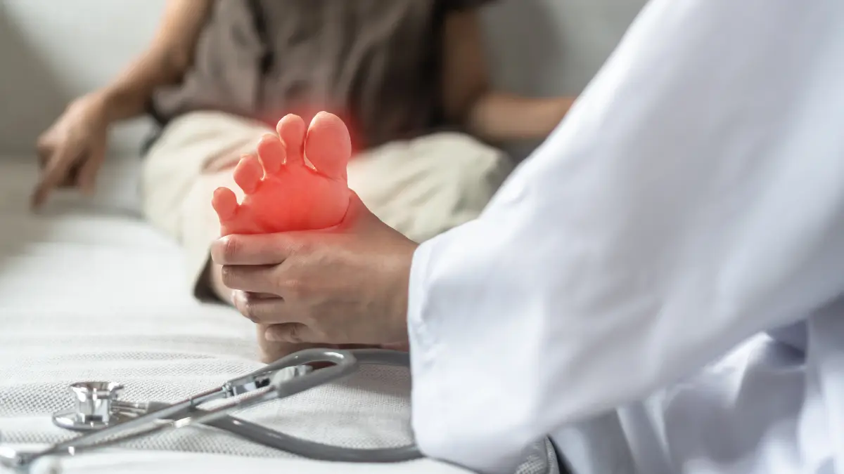 Arzt untersucht den Fuß eines Patienten mit chronisch inflammatorischer demyelinisierender Polyneuropathie (CIDP).