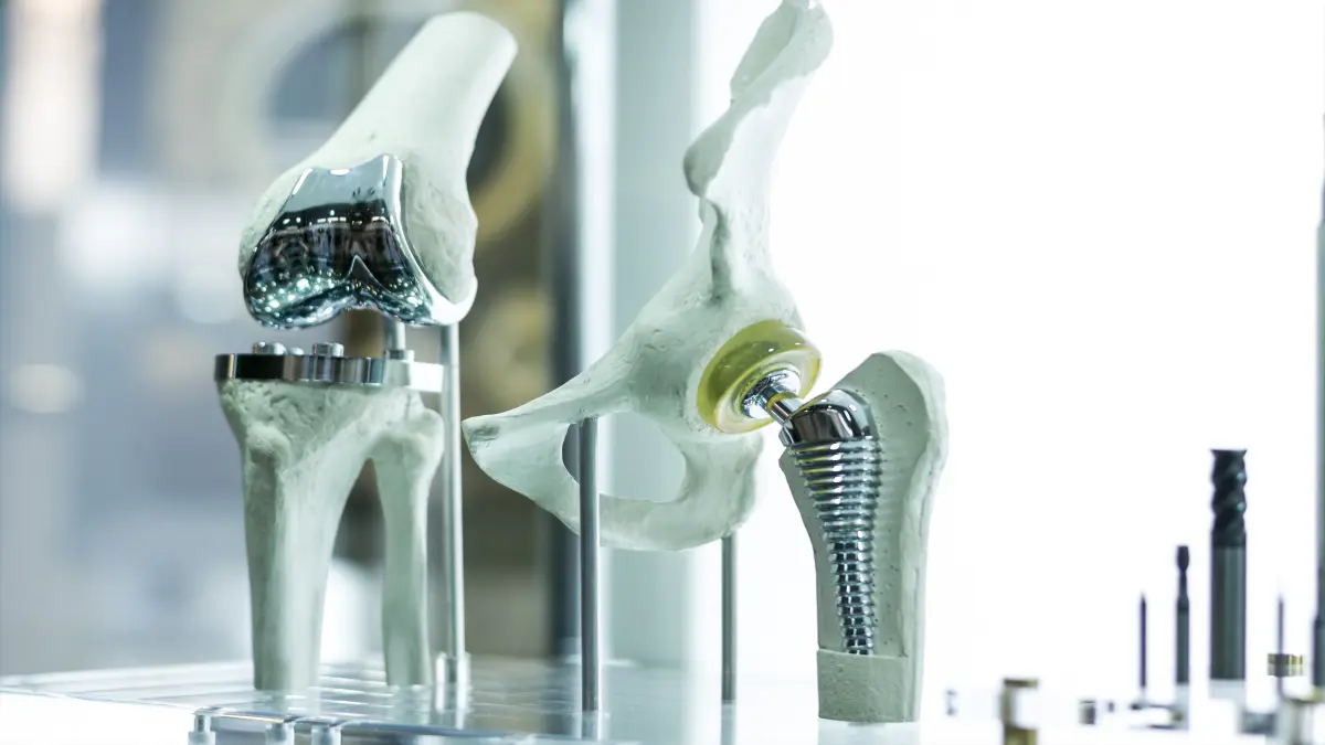 Moderne Knie und Hüftprothese gefertigt durch CAD-Konstruktion und hergestellt mittels 3D-Druck.