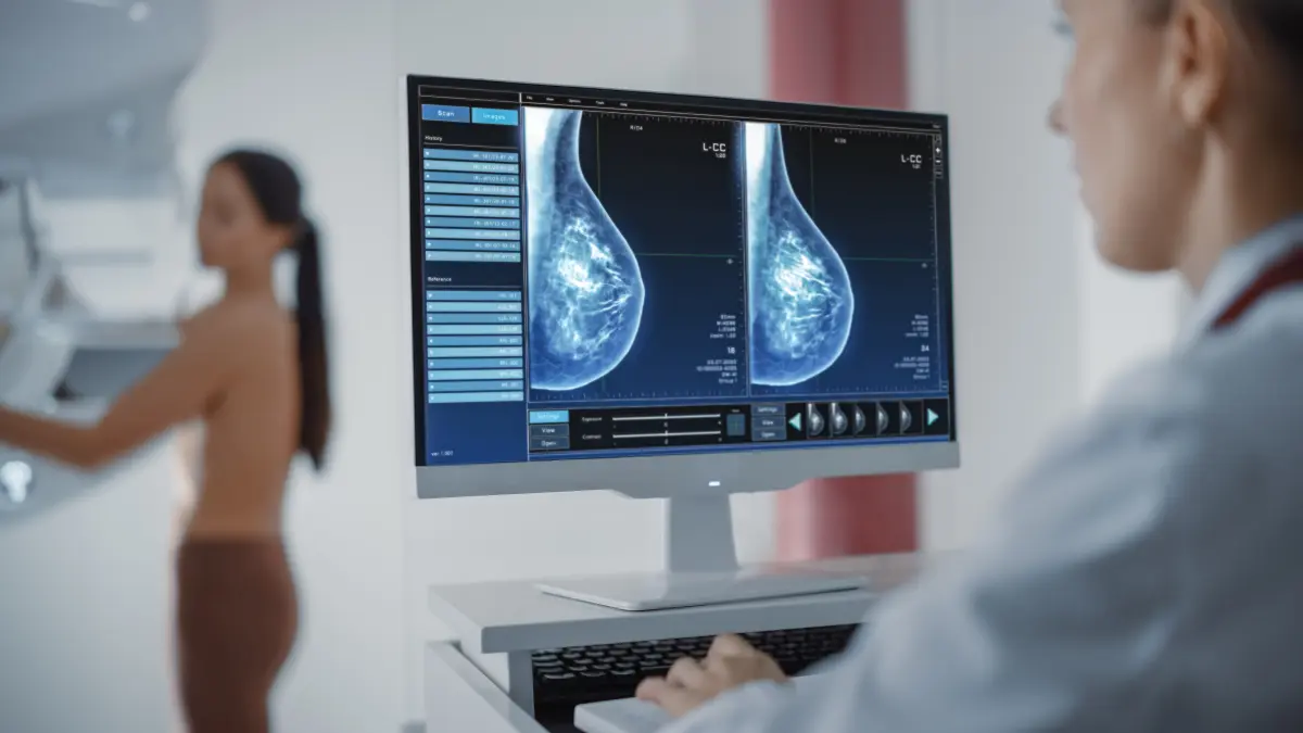 Mammografie-Bildschirm zeigt Brustkrebsdiagnose mit L-CC-Aufnahmen