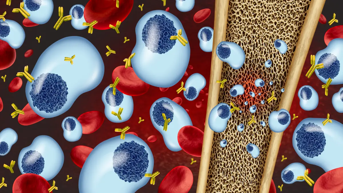 Wissenschaftliche Darstellung von Plasmazellen, roten Blutkörperchen und Knochenmark, symbolisiert die Forschung und Behandlung des Multiplen Myeloms.