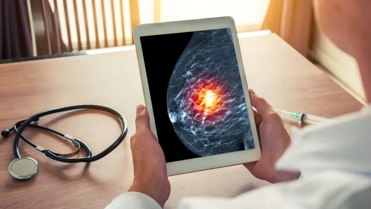 Brustkrebs triple-negativ Forschung: Arzt betrachtet Mammographie mit markierter Tumorregion.