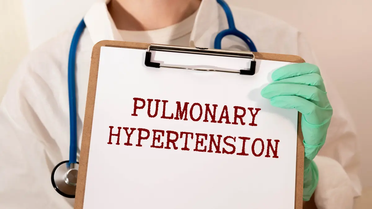 Darstellung eines medizinischen Fachpersonals mit einem Klemmbrett, auf dem „Pulmonary Hypertension“ geschrieben steht, als Hinweis auf die Behandlung und Diagnose der pulmonalen Hypertonie.