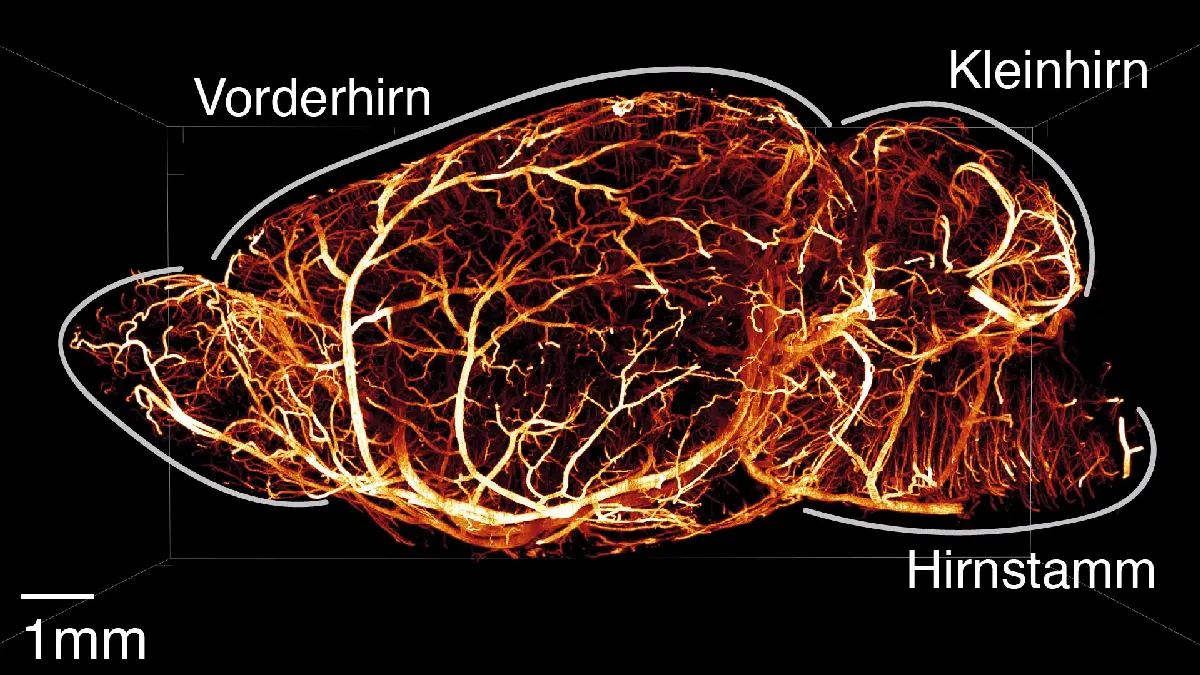 Gehirn einer Maus in 3D mit Lichtblattmikroskopie