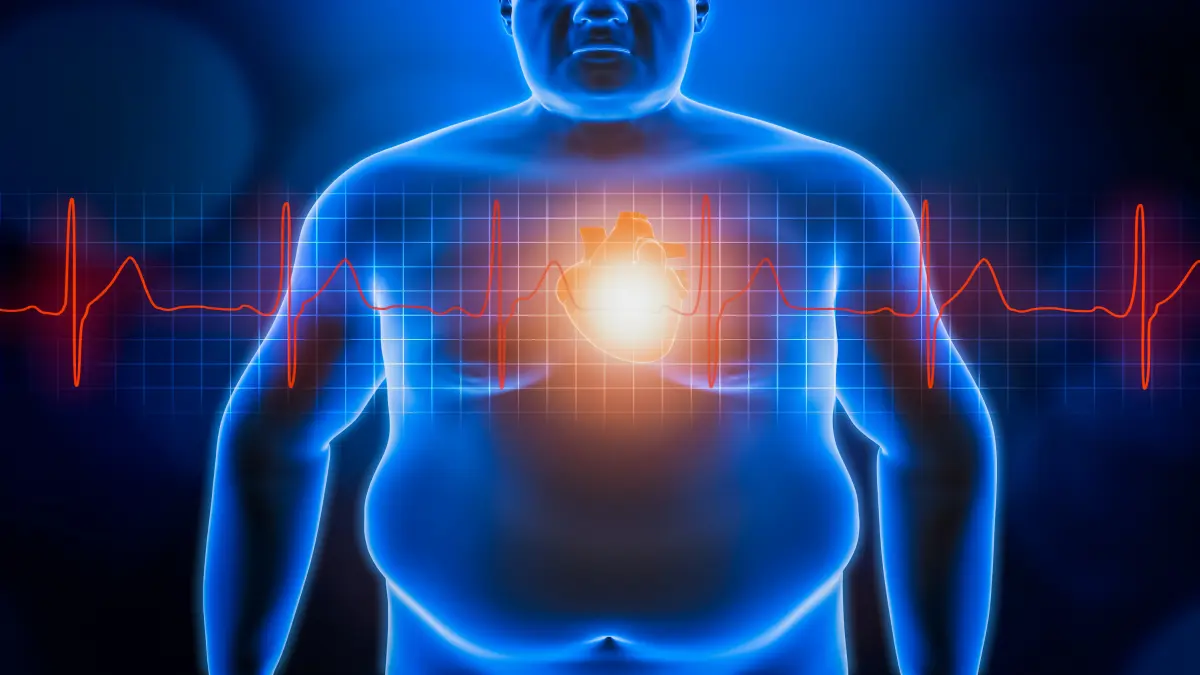 Illustration einer Person mit Adipositas, im Brustbereich leuchtendes Herz und EKG-Linie als Hinweis auf Herzgesundheit