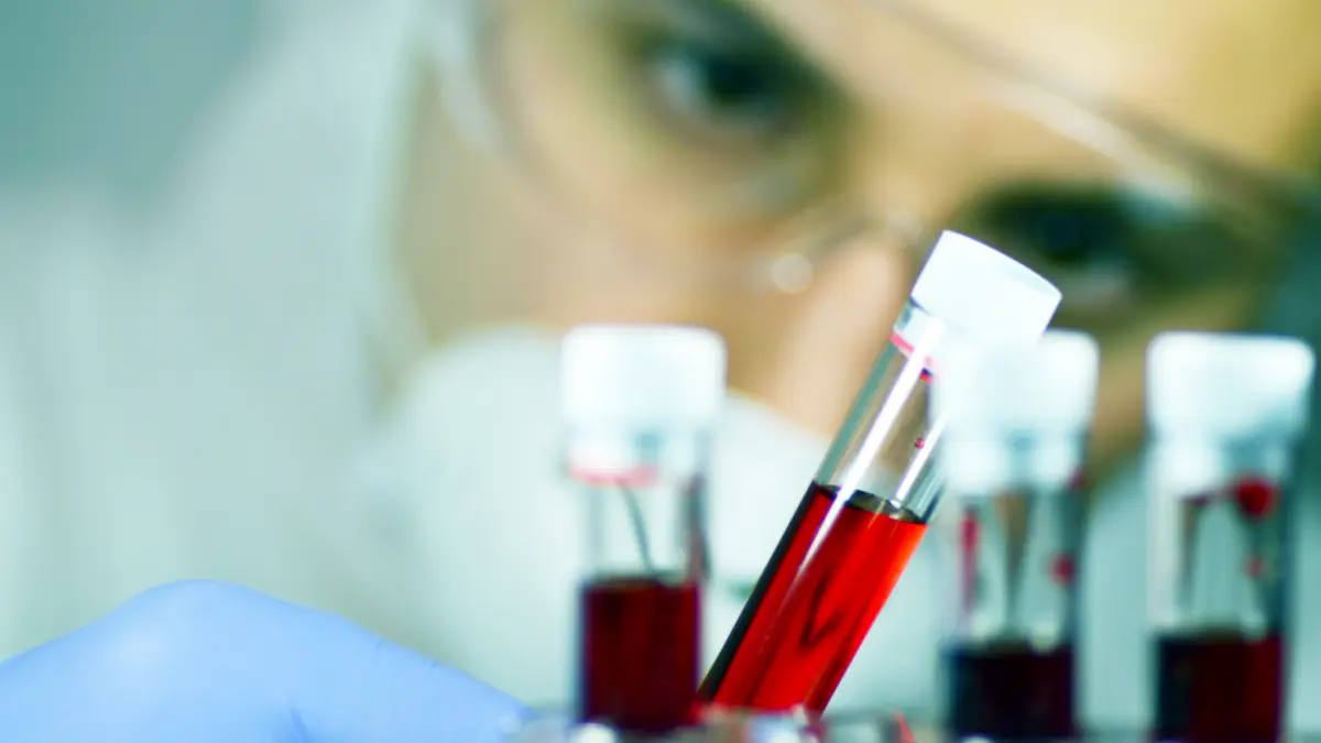 Blut wird im Labor untersucht
