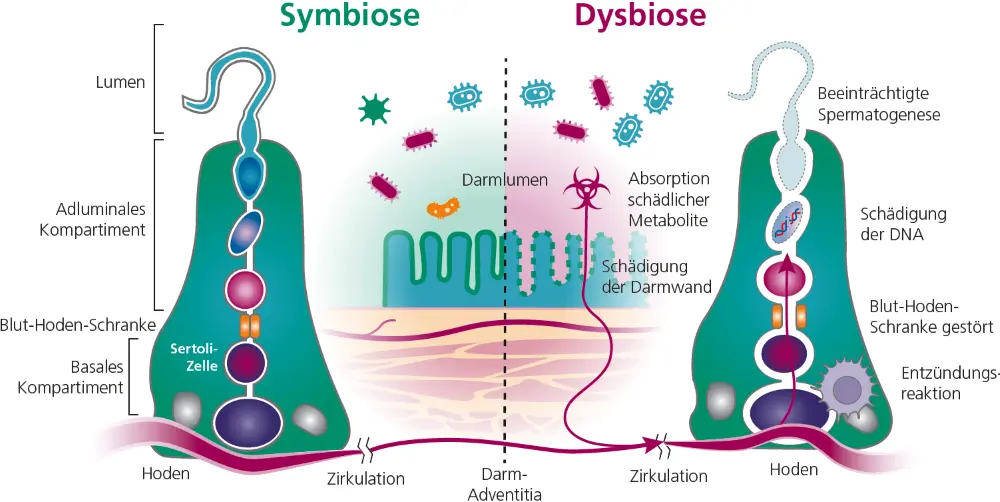 Abb. 2: Mögliche pathophysiologische Mechanismen, durch die das Darm-Mikrobiom
die Hodenfunktion beeinflussen könnte (modifiziert nach [15]).