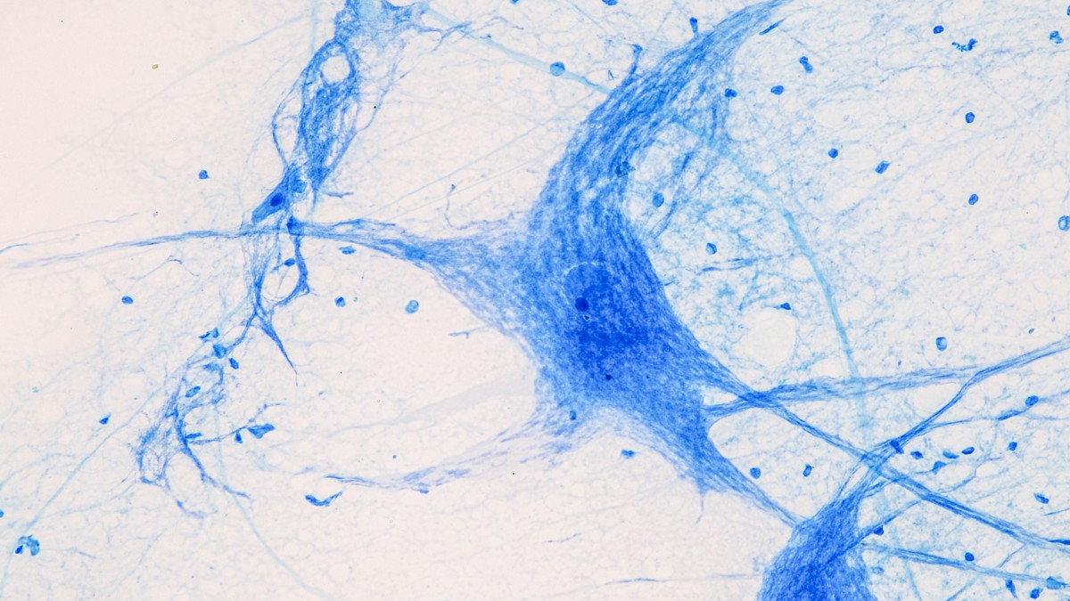 Neurofilamente