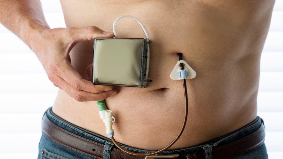 Parkinson-Patient mit Pumpe