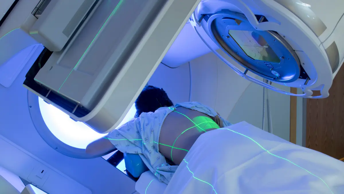 Patient liegt auf Behandlungsliege eines Linearbeschleunigers während der Strahlentherapie – grüne Positionierungslaser markieren das Bestrahlungsfeld bei der Krebsbehandlung