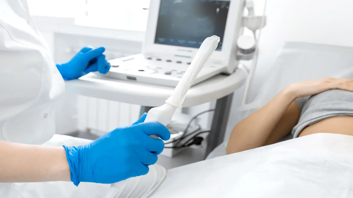 Ärztin mit blauen Handschuhen hält transvaginalen Ultraschallkopf vor Ultraschallgerät – Symbolbild für gynäkologischen Ultraschall als IGeL-Leistung