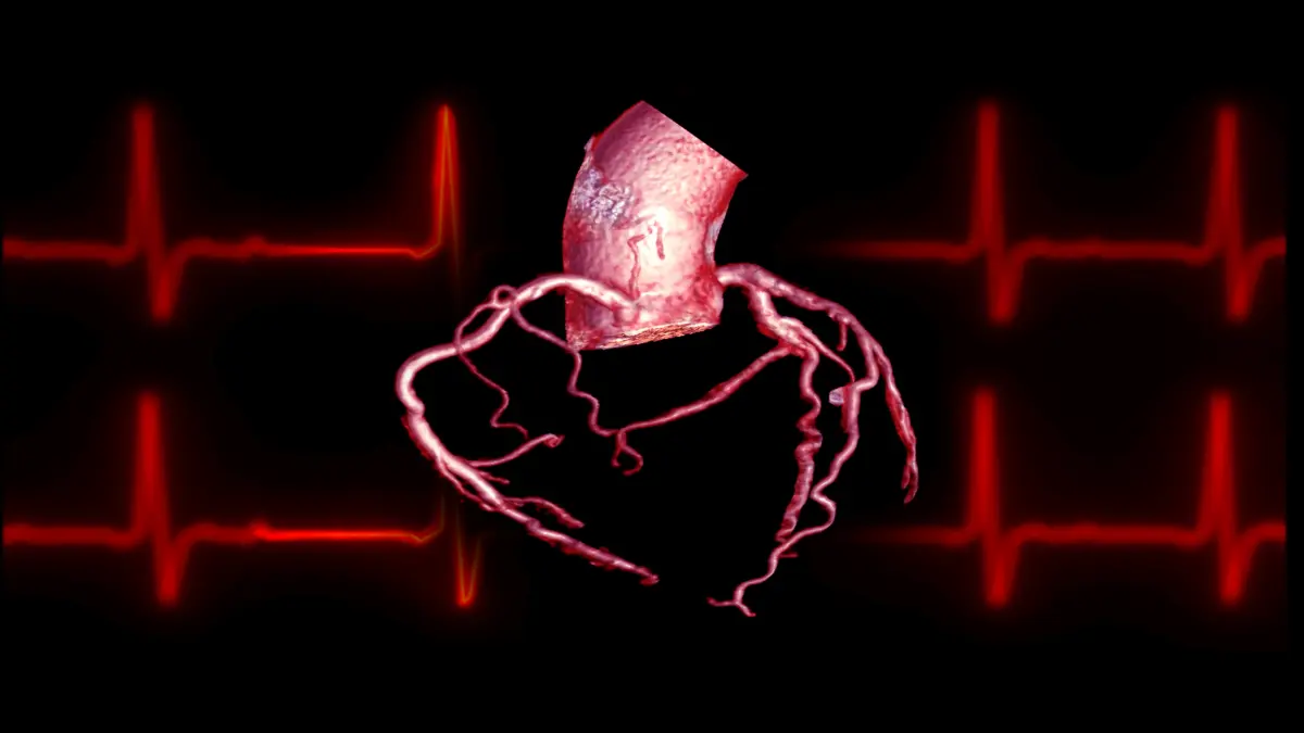 3D-Visualisierung der Koronararterien des menschlichen Herzens vor einem roten EKG-Hintergrund
