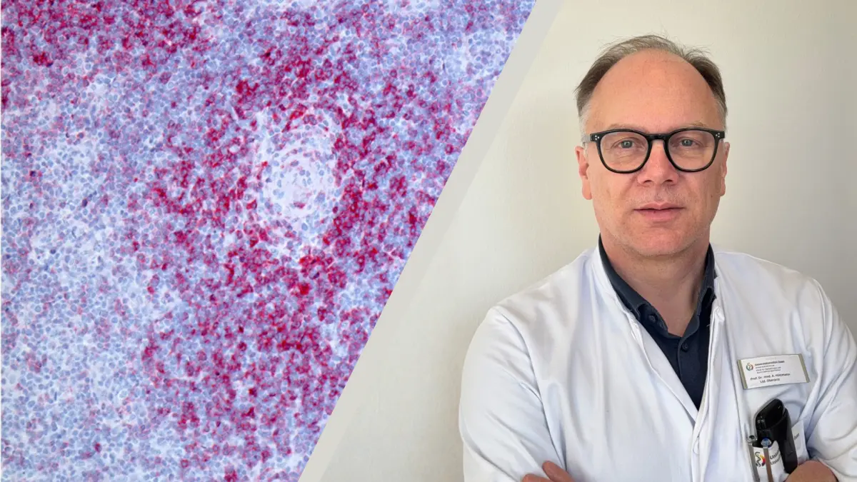 Collage: gefärbte Mikroskopaufnahme von Lymphknotengewebe links und Klinikportrait eines Ärztlichen Leiters rechts – REACT Projekt zu T Zell Lymphomen (Lymphdrüsenkrebs)