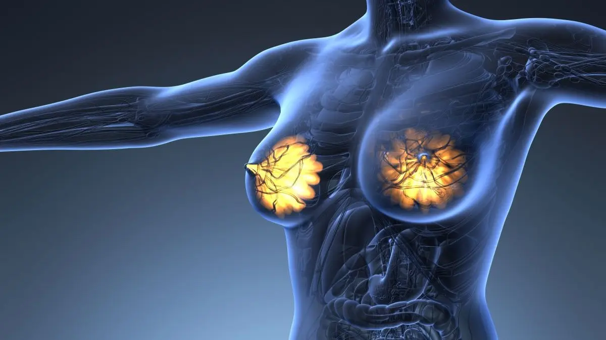 3D anatomische Darstellung des weiblichen Oberkoerpers mit hervorgehobenen Brustdruesen als Symbol fuer Mammakarzinom und Leitlinienempfehlungen