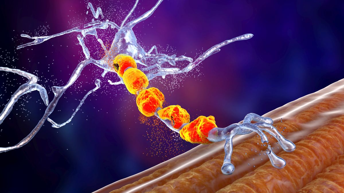 Neuroinflammation bei Multiple Sklerose: beschädigtes Myelin