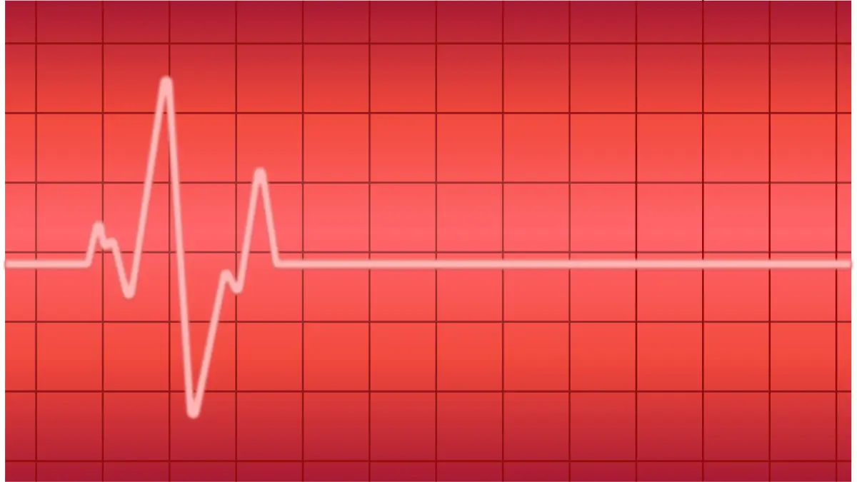 EKG-Kurve läuft in eine Flatline – Symbol für Herzstillstand