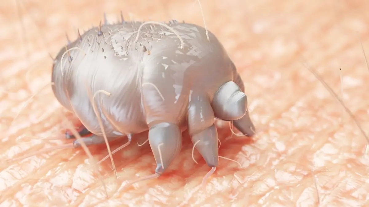 Detailreiche 3D Illustration einer Skabiesmilbe auf menschlicher Haut fuer den EADV Outlook Scabies Whats new