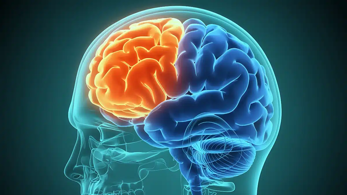 3D-Illustration des menschlichen Gehirns mit hervorgehobenem Frontallappen bei ALS-FTSD