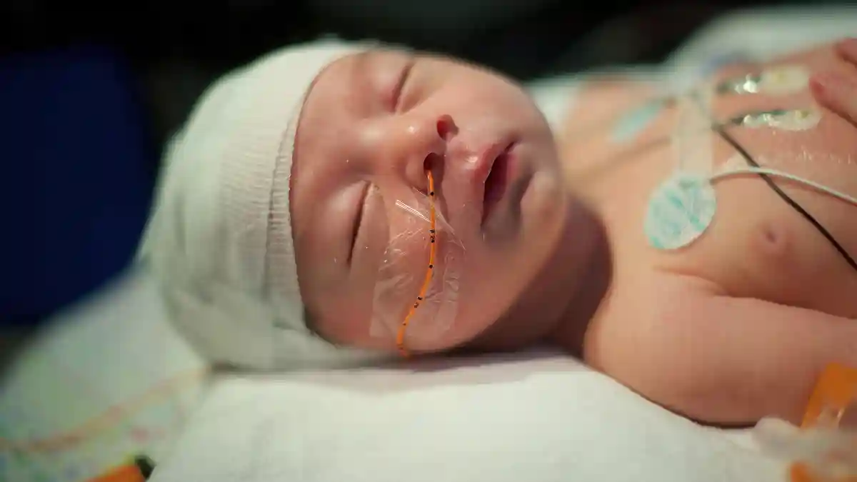 Das Bild zeigt ein Neugeborenes mit einer Hirnverletzung, das in einem Bett auf der neonatologischen Intensivstation schläft, mit Sauerstoffmonitor und Kopfverbänden.
