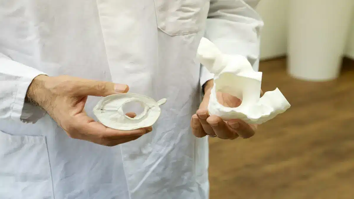 Arzt hält Trikuspidalklappenprothese und 3D-Herzmodell – Einsatz bei minimalinvasivem Klappenersatz