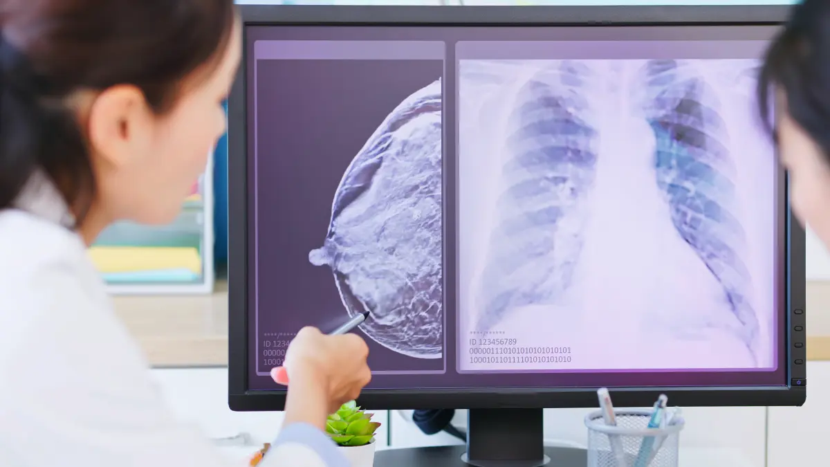 Radiologin betrachtet am Monitor eine Mammographieaufnahme und ein Thoraxroentgenbild im Rahmen der Brustdiagnostik