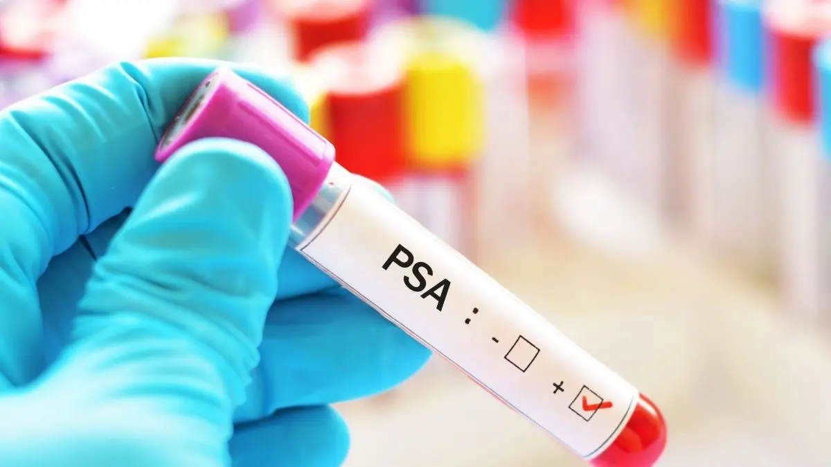 Nach der negativen Bewertung des risikoadaptierten PSA-MRT-Screenings des Prostatakarzinoms (RAS) im IQWIG-Vorbericht diskutieren Urologen im Uroskop die Argumente des IQWIG und die weiteren Chancen für eine moderne PCa-Früherkennung. © iStock