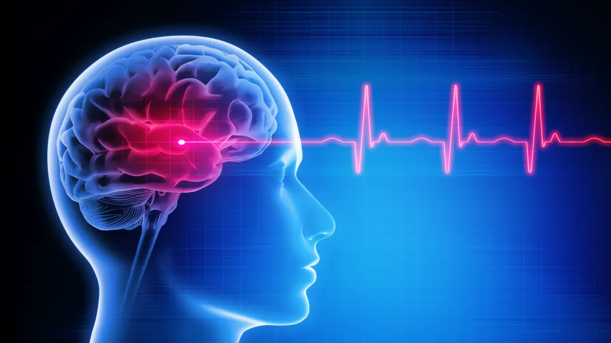 Medizinische Illustration eines Gehirns mit hervorgehobenen Hirnstrukturen und EKG-Linie zur Darstellung des Schlaganfallrisikos bei Vorhofflimmern.