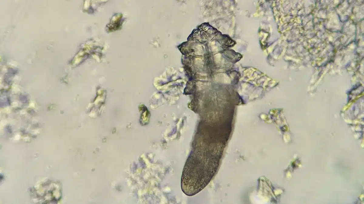 Demodex Milbe unter Mikroskop