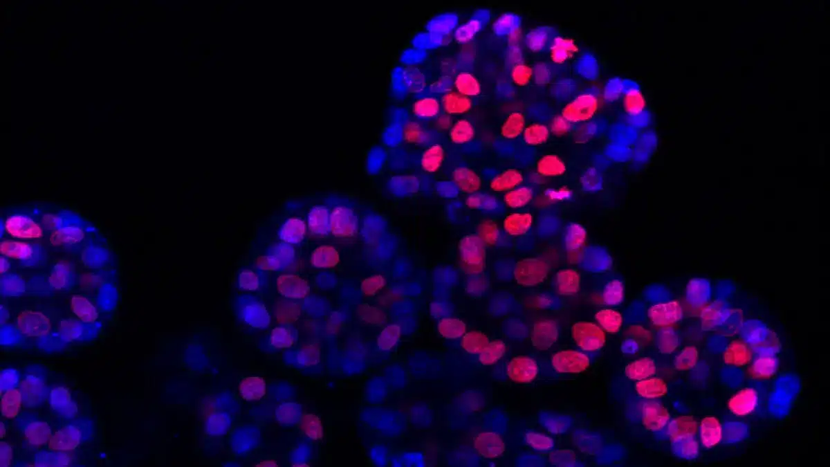 Fluoreszenzaufnahme von Krebszellen in Organoiden mit blau und pink angefaerbten Zellkernen als Symbolbild fuer die Entwicklung neuer Wirkstoffkombinationen gegen Leberkrebs