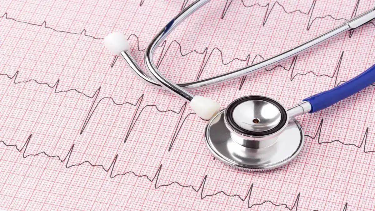 Stethoskop auf einem EKG zur Darstellung der Herzgesundheit nach Myokardinfarkt
