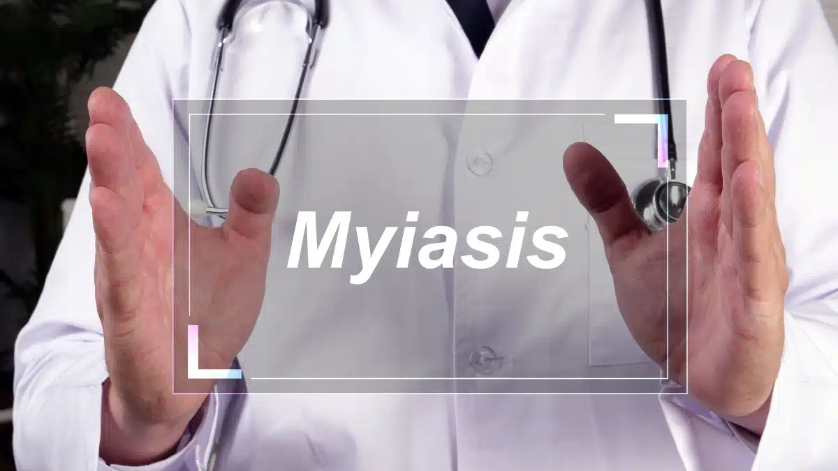 Arzt hält Schild mit der Aufschrift "Myiasis"
