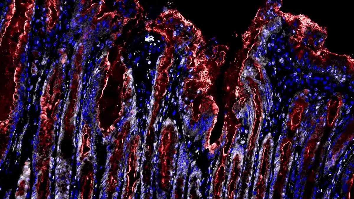 Fluoreszenzaufnahme einer Magenschleimhaut mit langgestreckten Krypten in Blau und Rot, die entzündliche und umgebaute Bereiche bei Helicobacter-pylori-Infektion zeigt