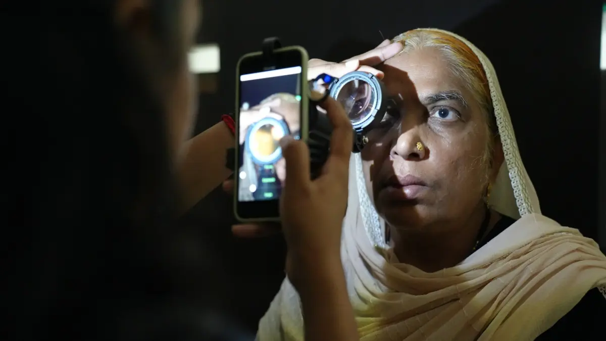 Smartphone-Netzhautuntersuchung bei einer Frau in Indien im Screening auf diabetische Retinopathie